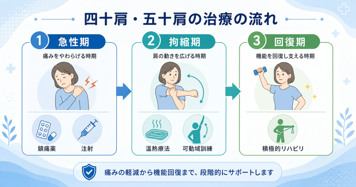 ■四十肩・五十肩の治療法――時期に合わせた治し方の選択肢