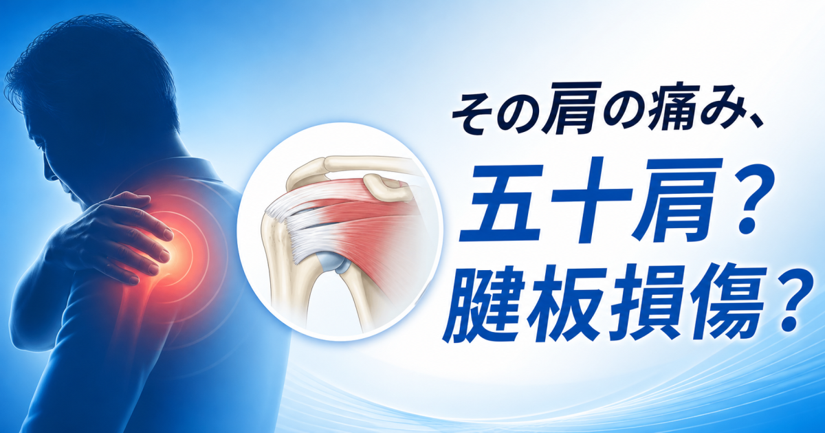 「腕を上げると肩が痛い」これ、五十肩じゃないかも？　肩腱板損傷との違いについて